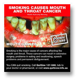 throat cancer from tobacco