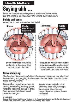 Curbing oral cancer pic