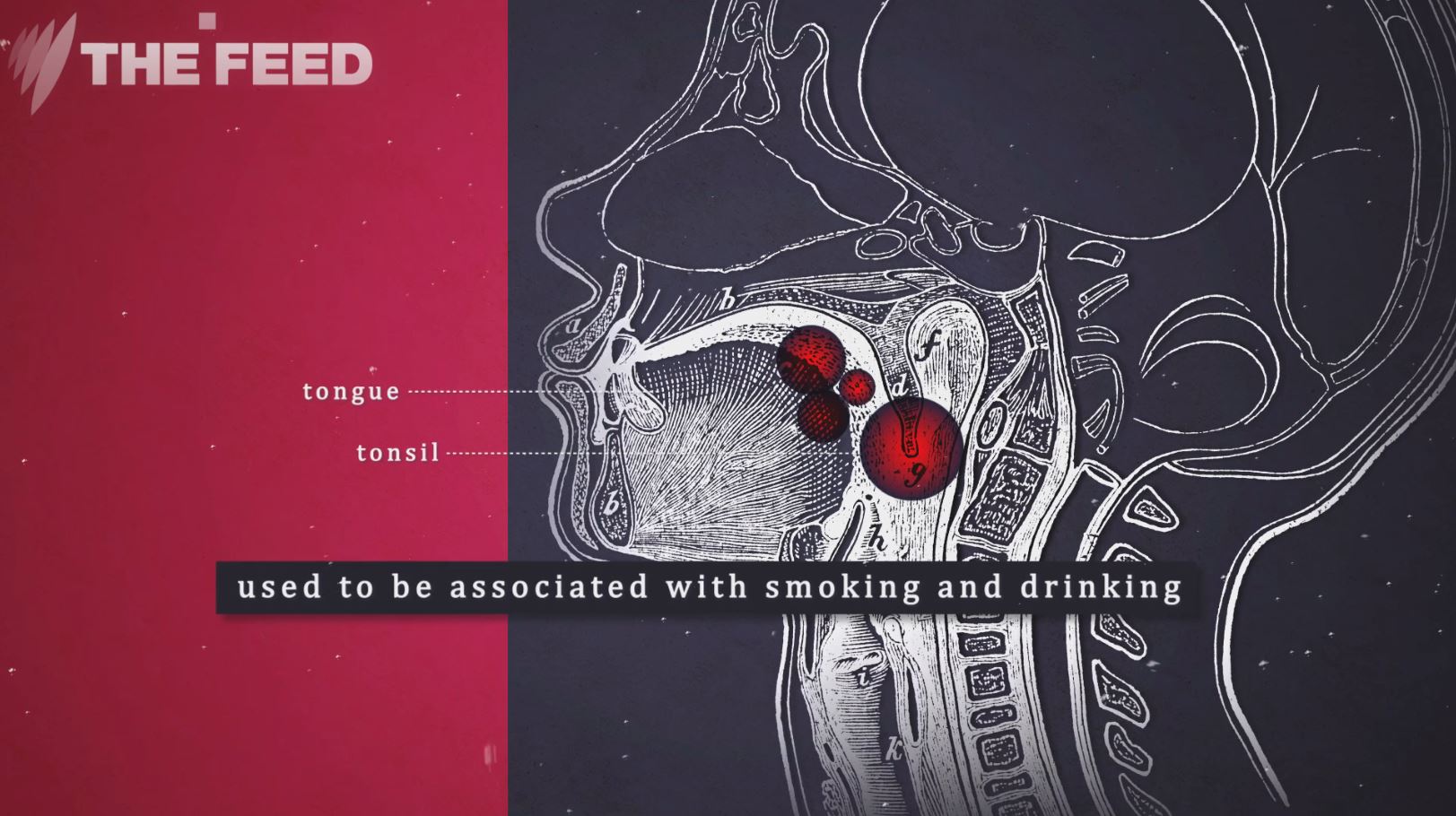 Oral Sex And ‘deep Kissing Linked To Increase In Hpv Positive Head And