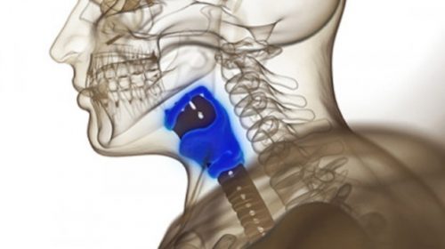 Thanks to the implant, a 56-year-old throat cancer patient can now whisper and breathe normally. © ChrisChrisW / Istock.com
